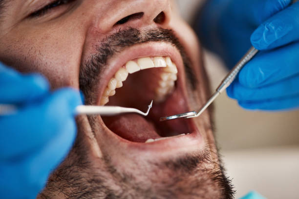 Best Urgent Care for Lost Fillings or Crowns in Stirling, NJ